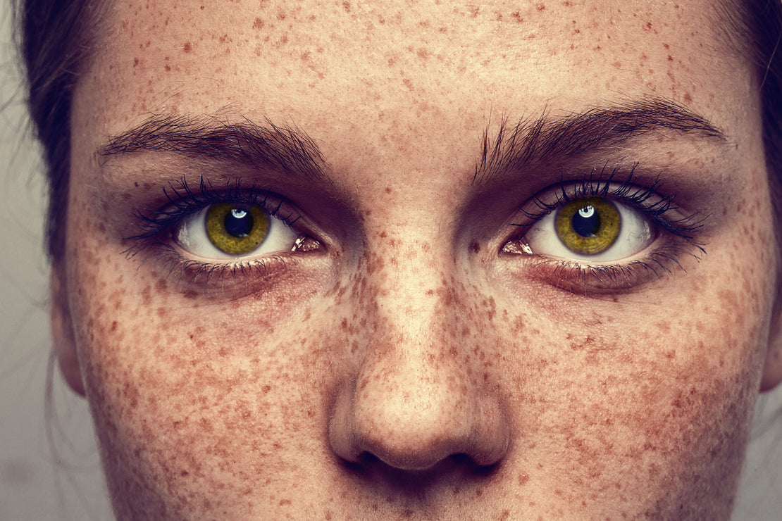 Close up of lady with sun damage